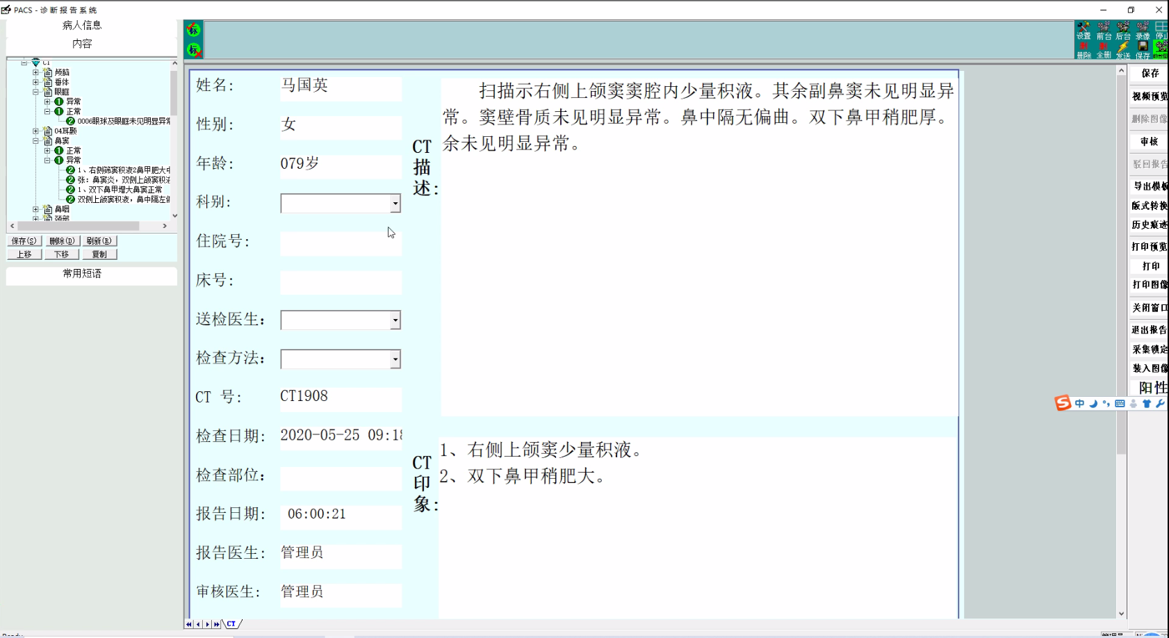 PACS源码 影像管理信息系统PACS源码 三维多平面重建PACS源码 阿里云开发者社区