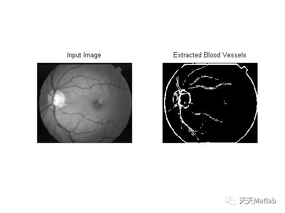 【图像分割】基于计算机视觉实现视网膜图像中的血管分割附matlab代码
