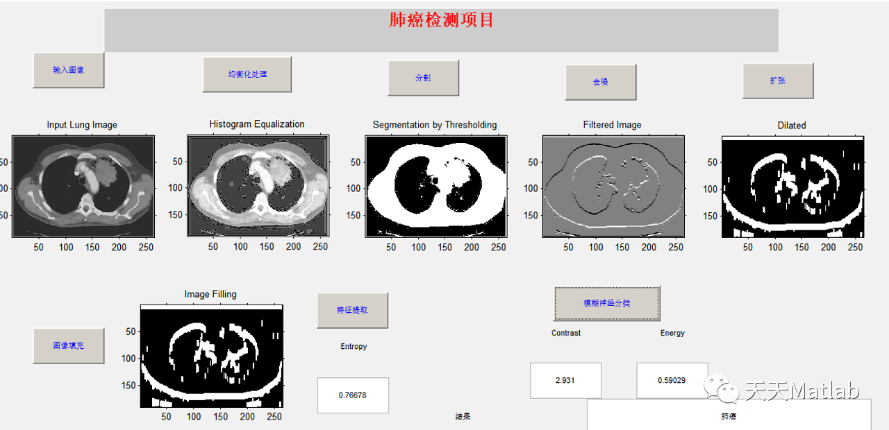 【图像识别】基于神经网络实现肺癌图像识别研究附matlab代码