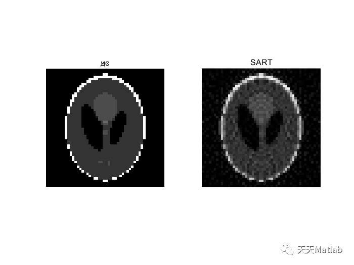 【图像重建】基于ART算法和SIRT算法实现超声CT反演附MATLAB代码