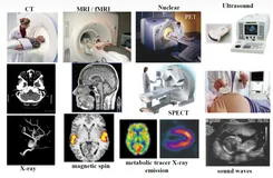 【Medical Images-1】医学图像中常见的数据格式