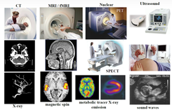 【Medical Images-1】医学图像中常见的数据格式