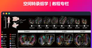 空间转录组: Visium HD 数据集分析 (完结)