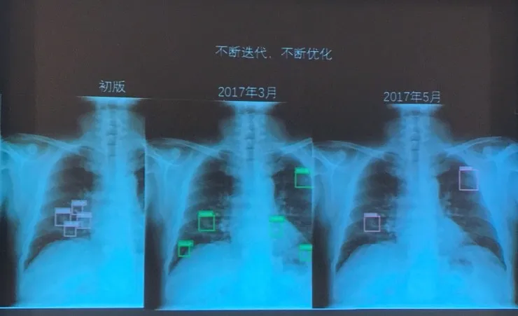 基于 AI-DR 来谈， AI 医疗影像该如何落地？