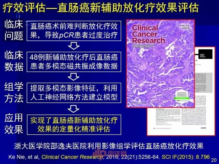 深度丨中科院田捷博士：基于医疗大数据和AI技术的影像组学及其应用丨CCF-GAIR 2017