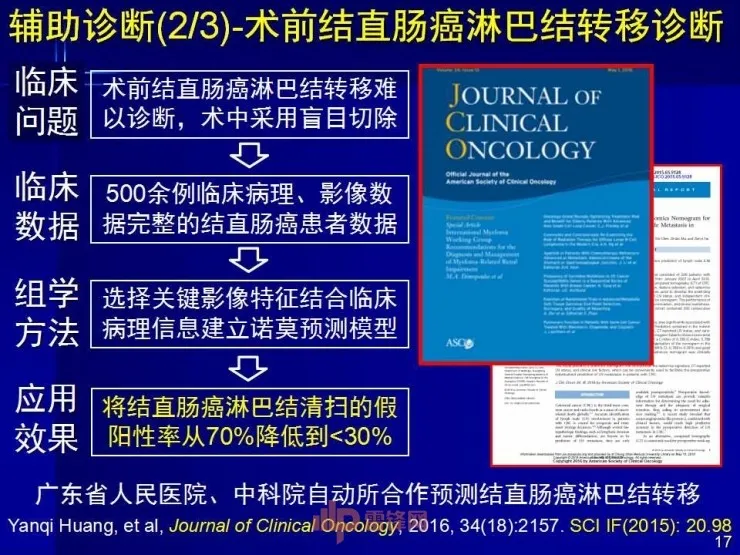 深度丨中科院田捷博士：基于医疗大数据和AI技术的影像组学及其应用丨CCF-GAIR 2017