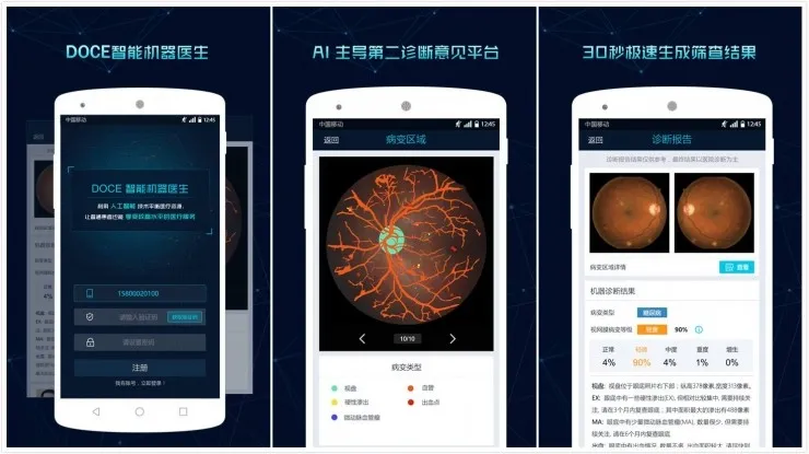 肽积木用 AI 辅助医生「看片」， 诊断糖网病速度提升 20 倍