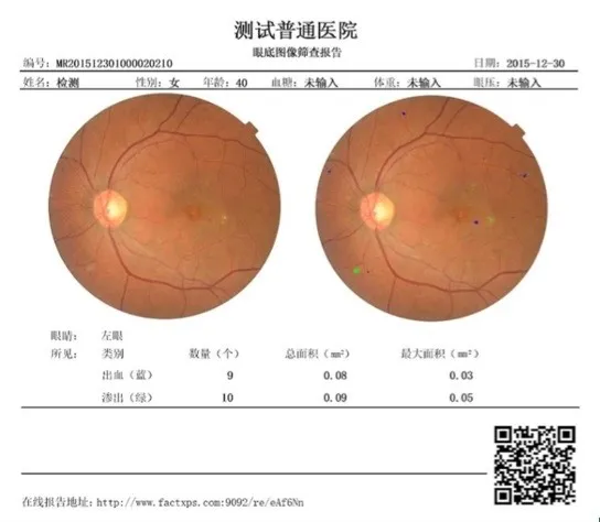 探讨医疗人工智能之眼科AI的真实应用场景（肽积木CEO柏文洁）丨硬创公开课