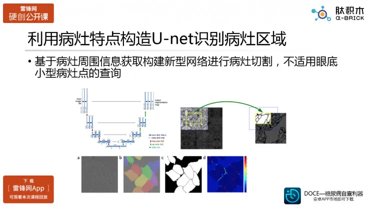 探讨医疗人工智能之眼科AI的真实应用场景（肽积木CEO柏文洁）丨硬创公开课