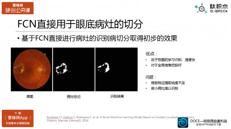 探讨医疗人工智能之眼科AI的真实应用场景（肽积木CEO柏文洁）丨硬创公开课