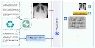 中文多模态医学大模型智能分析X光片，实现影像诊断，完成医生问诊多轮对话