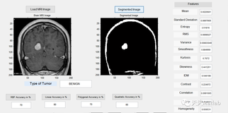 【图像检测】基于多种特征结合支持向量机实现脑 MRI 肿瘤检测和分类附Matlab 代码