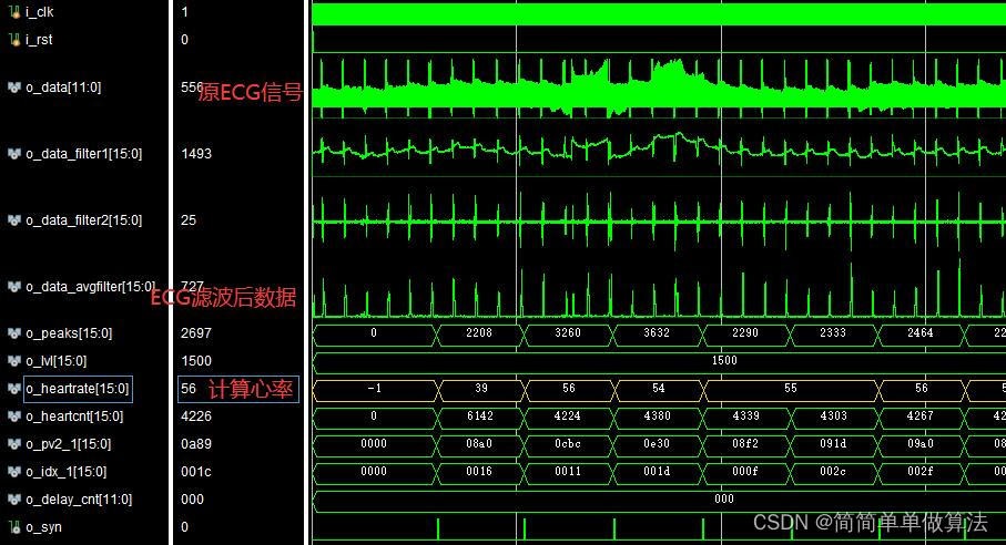 基于FPGA的ECG信号滤波与心率计算verilog实现,包含testbench