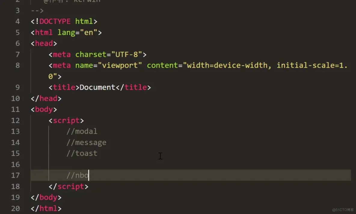 前端学习笔记202306学习笔记第五十二天-桥接模式3