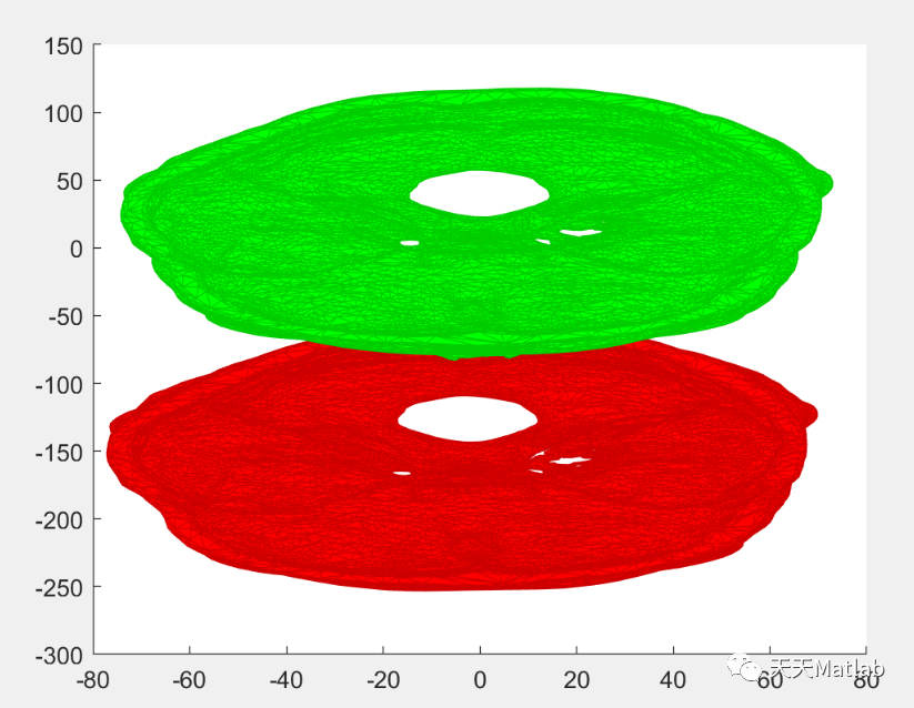 用于准确量化颅面对称性和面部生长的 3D 头影测量方案（Matlab代码实现）