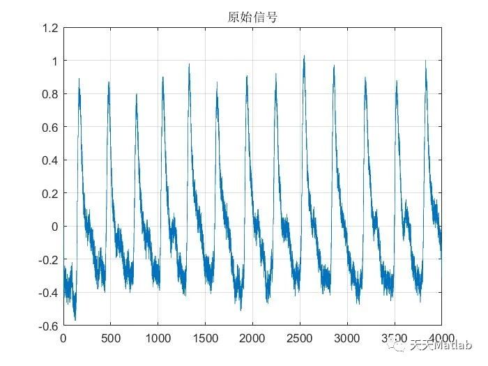 【信号去噪】基于小波变换实现脉搏信号去噪附Matlab代码