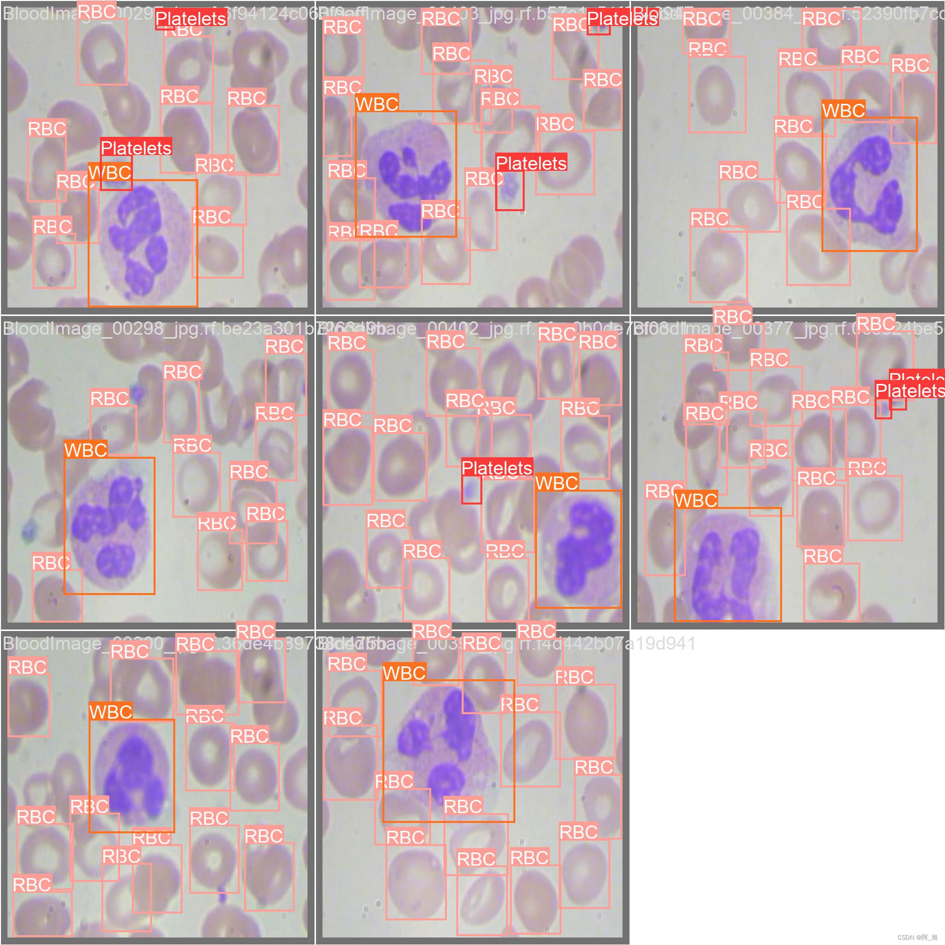 基于yolov8深度学习的血细胞检测与计数系统【python源码 pyqt5界面