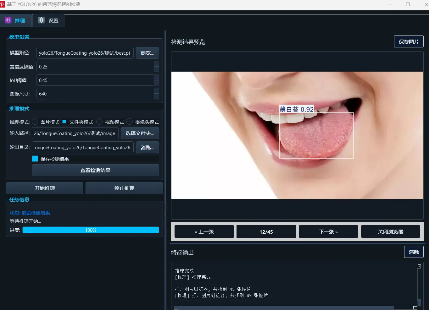 (此处展示舌苔检测的实际效果图片,包括各类舌苔的检测结果展示)