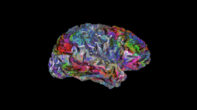 发表Nature封面论文「大脑语义地图」之后的研究进展