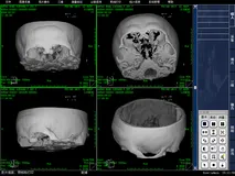 PACS影像信息数字化存储系统源码，C/S架构的医学影像系统源码