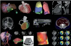PACS系统源码 运维级医院PACS系统源码
