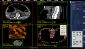 PACS系统源码 大型医院PACS源码 支持专业三维影像后处理功能