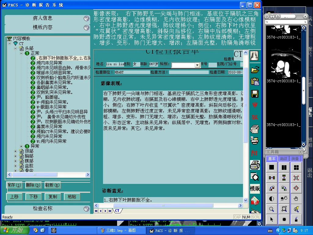 诊断报告系统.png