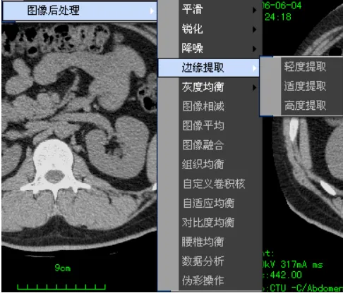 高级算法.png