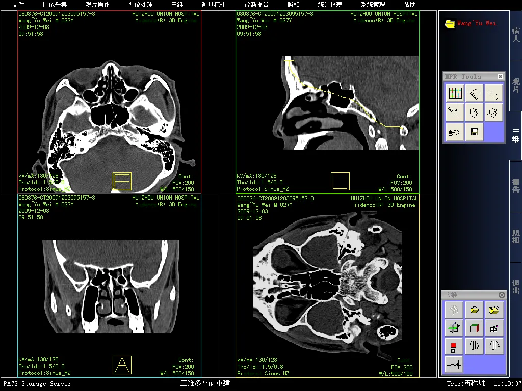 三维多平面重建.jpg