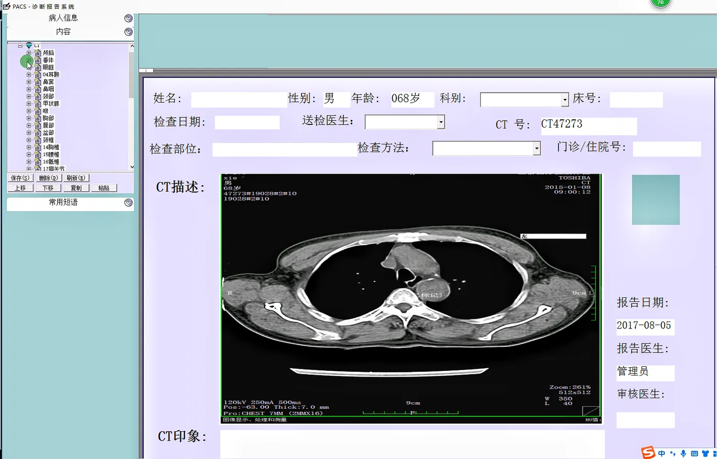 CT报告.png