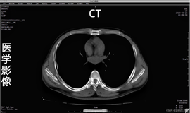 PACS医学影像信息化数字平台源码