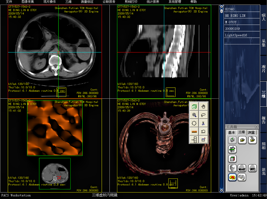 【C++】支持CT、彩色超声、内窥镜检查de医院影像PACS（三维重建技术）