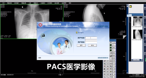 医学影像PACS系统：一种用于存储、管理和传输医学影像数据的系统