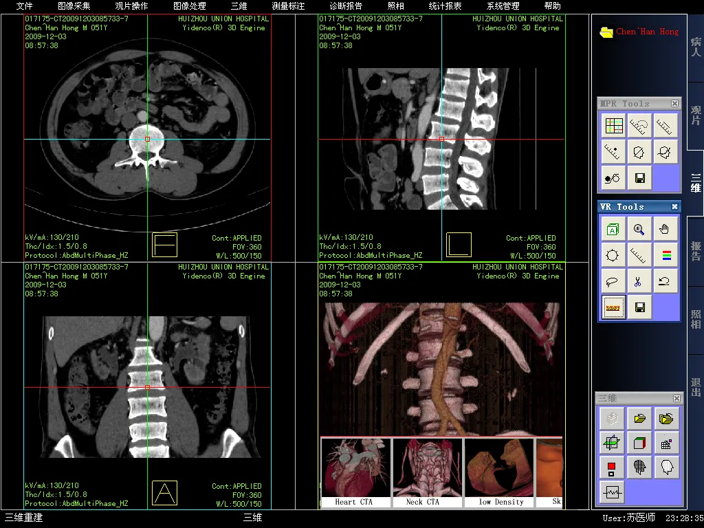 三维容积重建.jpg