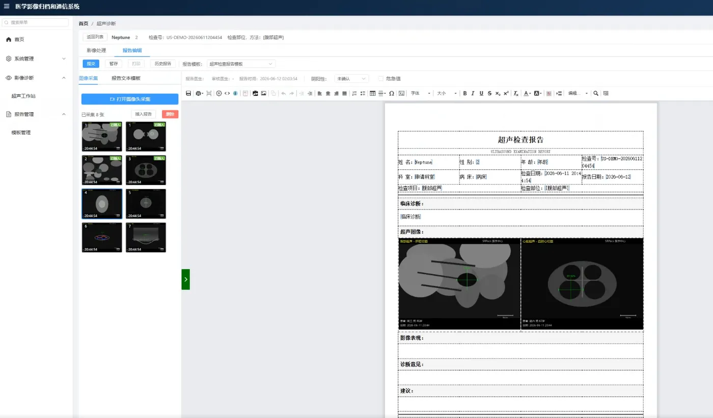超声检查报告.png