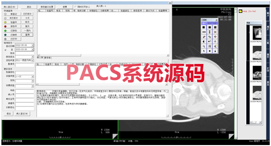 C语言C/Ｓ架构PACS影像归档和通信系统源码 医院PACS系统源码