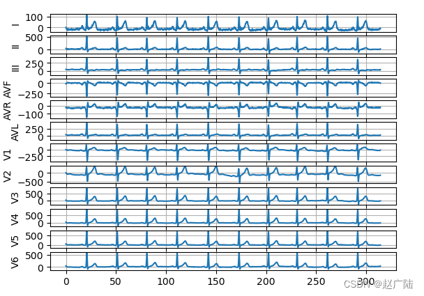 深度学习Heartpy心电图分析-阿里云开发者社区