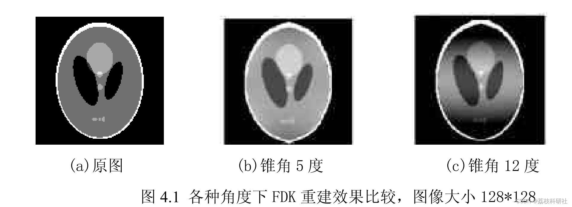 【图像重建】使用FDK的三维谢普洛根幻影重建（Matlab代码实现）