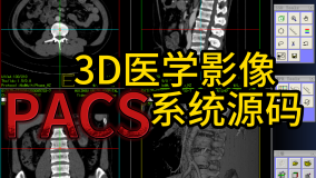 突破传统 重新定义：3D医学影像PACS系统源码（包含RIS放射信息） 实现三维重建与还原