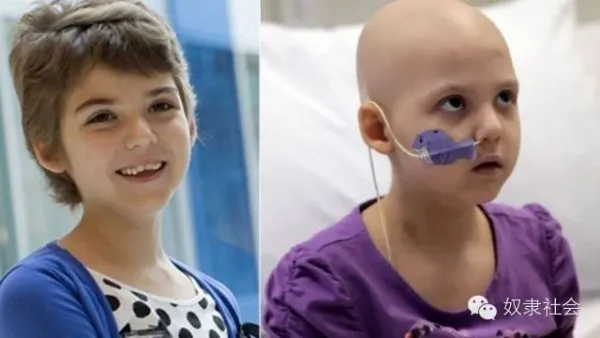 CAR-T免疫疗法,治愈癌症不是梦