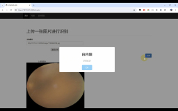【眼疾病识别】图像识别+深度学习技术+人工智能+卷积神经网络算法+计算机课设+Python+TensorFlow