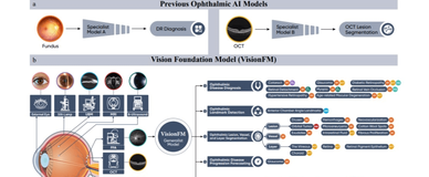 VisionFM：通用眼科 AI 大模型，具备眼科疾病诊断能力，展现出专家级别的准确性