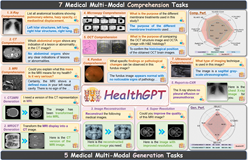 HealthGPT：你的AI医疗助手上线了：支持X光到病理切片，诊断建议+报告生成全自动